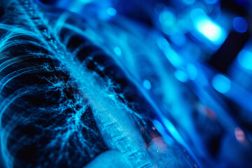 Lung x-ray in the hospital. Diagnostics, and Medicine and health care concept