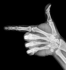 Obraz premium Film xray x-ray or radiograph of a thumb and finger in gestural language, manual communication, or signing aka sign language, pointing this way or that way to the left