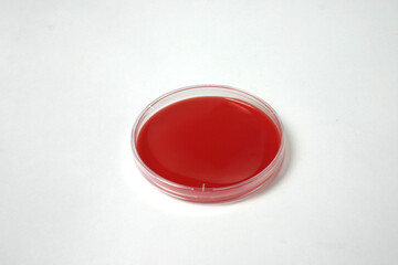 petri dish with blood-based medium