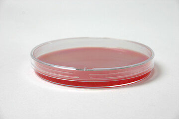 petri dish with blood-based medium