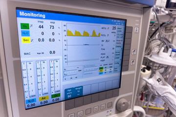 Hospital monitor displaying vital signs: heart rate, blood pressure, oxygen levels, crucial for...