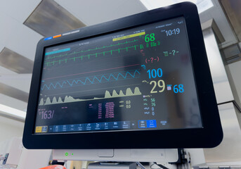 Hospital monitor displaying vital signs: heart rate, blood pressure, oxygen levels, crucial for patient health and medical assessment