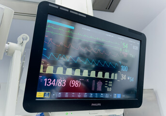 Hospital monitor displaying vital signs: heart rate, blood pressure, oxygen levels, crucial for...