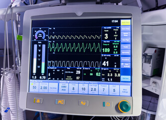 Hospital monitor displaying vital signs: heart rate, blood pressure, oxygen levels, crucial for patient health and medical assessment
