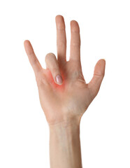 Fototapeta premium Woman suffering from trigger finger on white background, closeup