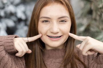 Close up portrait of face young caucasian beautiful woman blond hair smiling with braces. Happy...