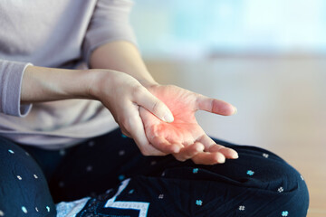 A woman touches the palm of her hand with a red area to indicate the pain point.