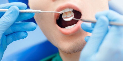 Dentistry clinic banner, young man getting dental checkup. Dentist using equipment probe and mirror...