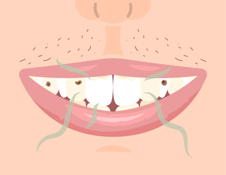 An illustration of a mouth that emits an unpleasant odor. poorly maintained teeth. The teeth are yellow, a lot of tartar, and bad breath. condition of the mouth or teeth. flat illustration design
