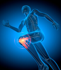 Running man with pain in knee joint - 3D illustration