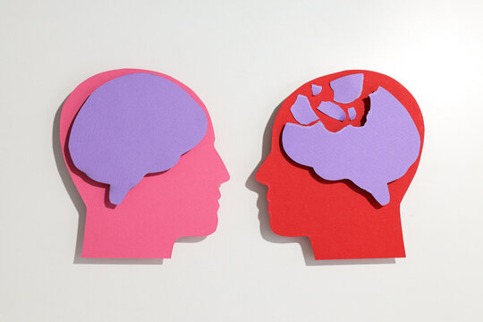 A model of a healthy and brain damaged by sclerosis