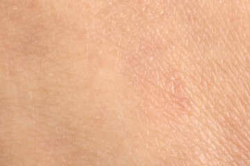 Texture of healthy skin as background, macro view