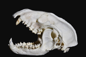 Naklejka premium Periodontal disease, also known as gum disease.