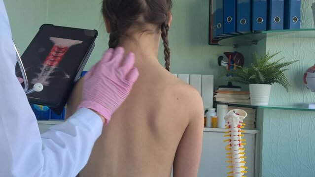 Pediatrician examines x-ray of inflammation of neck and spine in a child. Appearance of systematic back and neck pain in children and adolescents