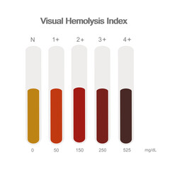 The Hemolysis Visual index were interpreted in the level of Normal or Zero and plus of 1 to 4 that represent in the chart of red color of serum and concentration of hemoglobin.