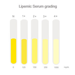 The Lipemic serum grading were interpreted in the level of Normal or Zero and plus of 1 to 4 that represent in the yellow color chart of transparent to turbidity of serum sample.