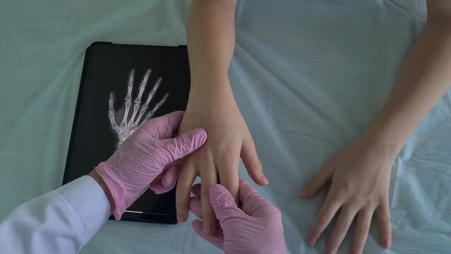 Female pediatrician shows x-ray of wrist and hand of little girl child. Child in doctor office with hand injury