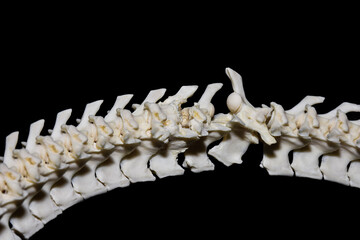 Naklejka premium Osteoarthritis, a degenerative joint disease