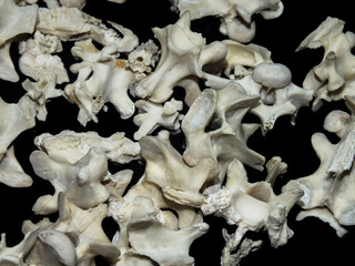 Osteoarthritis, a degenerative joint disease