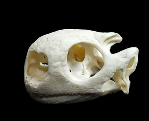 Periostitis, inflammation of the periosteum