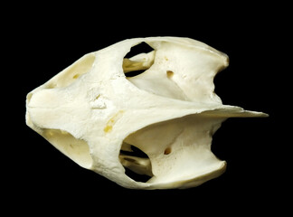 Periostitis, inflammation of the periosteum