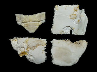 Superficial shell abscesses and erosions, or shell rot