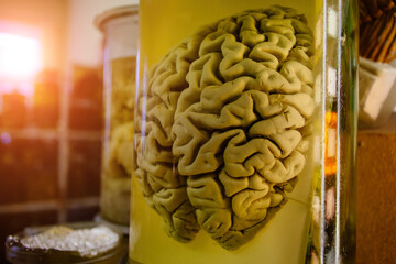 Human brain in glass jar with formaldehyde for medical studies