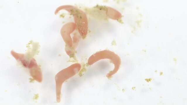 Study of Parasitic helminths (Trematodes) of marine fishes under a microscope.