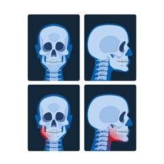 X-ray Pictures Of The Head, Or Cranial X-rays, Reveal Detailed Images Of The Skull And Brain, Aiding In The Diagnosis