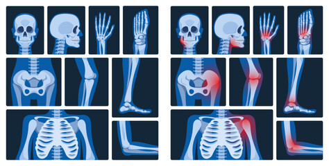 X-ray Pictures Are Medical Images Created By Exposing The Body To X-rays, Revealing Internal Structures For Diagnosing - obrazy, fototapety, plakaty