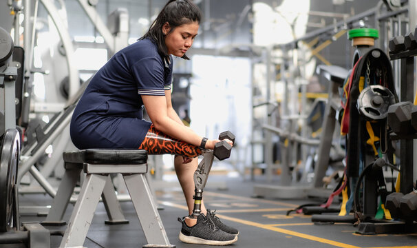 Woman with prosthetic leg sitting in gym lifting dumbbell weight. Female with foot prosthesis physical workout exercise in fitness. Artificial limb equipment help accident survivor amputee to mobility