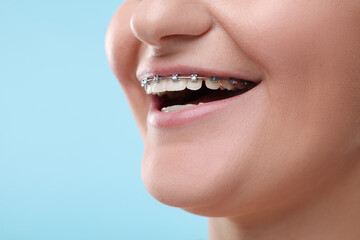 Smiling woman with dental braces on light blue background, closeup. Space for text