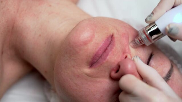 Professional cosmetologist doing hydrafacial procedure for women with vacumator while being a work. Cosmetology clinic concept