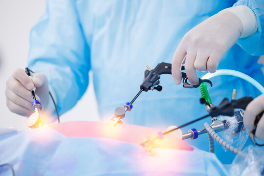 Minimally invasive surgery, team doctors use medical equipment, operating room hospital. Doctor surgeon holding laparoscopic instrument in abdomen of patient.