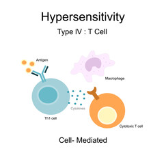 The Hypersensitivity type lV: Cell-mediated that represents the reaction diagram of Th1 cell and Cytotoxic T cell, Macrophage via Cytokine that secreted after binding of antigen and antibody.