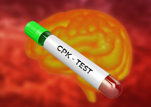 CPK creatine phosphokinase is an enzyme present in muscles, brain, lungs and heart