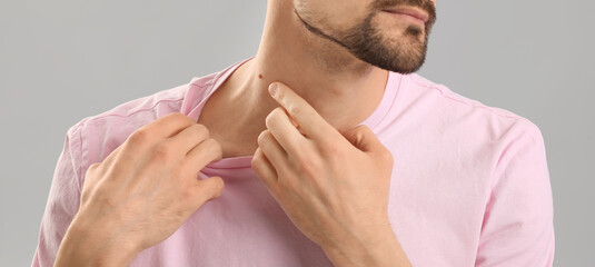 Man with mole on neck against grey background, closeup