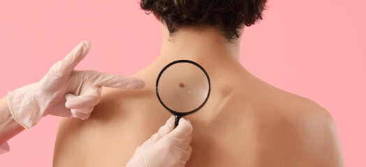 Doctor examining mole of young man on pink background. Concept of skin cancer - obrazy, fototapety, plakaty