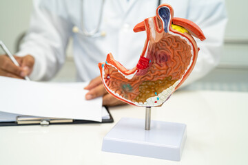 Stomach disease, doctor with human anatomy model for study diagnosis and treatment in hospital.
