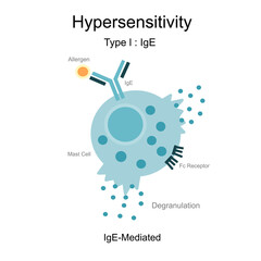 The diagram of Hypersensitivity type l : IgE (Immunoglobulin E) -mediated that represents the reaction between Allergen or antigen, Antibody (IgE) and Degranulation of mast cell.