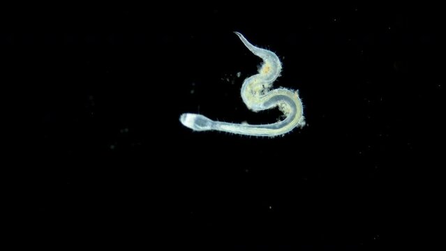 Worm nematoda family Draconematidae under microscope, possibly genus Draconema sp. Sample found in White sea