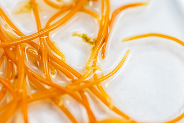 Backgrounds of Characteristics of Acanthocephalans (Thorny-headed worms, or spiny-headed worms)...