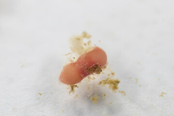 Study of Parasitic helminths (Trematodes) of marine fishes under a microscope.