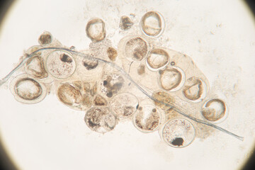 Study of Parasitic helminths (Trematodes) of marine fishes under a microscope.