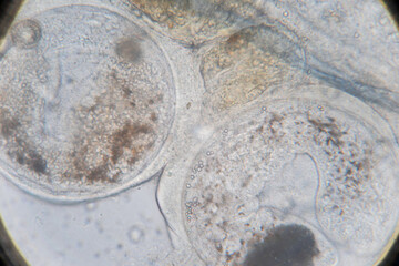 Study of Parasitic helminths (Trematodes) of marine fishes under a microscope.