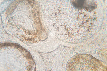 Study of Parasitic helminths (Trematodes) of marine fishes under a microscope.