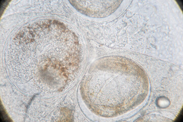 Study of Parasitic helminths (Trematodes) of marine fishes under a microscope.