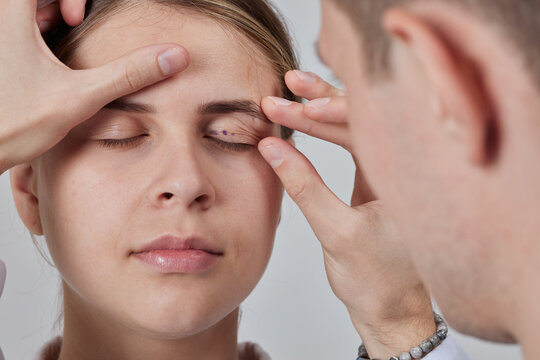 plastic surgeon prepares for Blepharoplasty, Blepharoplasty operation