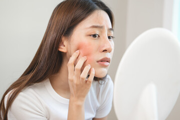 female have an face skin problems because cosmetic allergic.