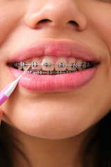 Unrecognizable female teenager cleaning her braces with an interdental brush.